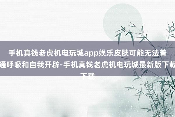 手机真钱老虎机电玩城app娱乐皮肤可能无法普通呼吸和自我开辟-手机真钱老虎机电玩城最新版下载